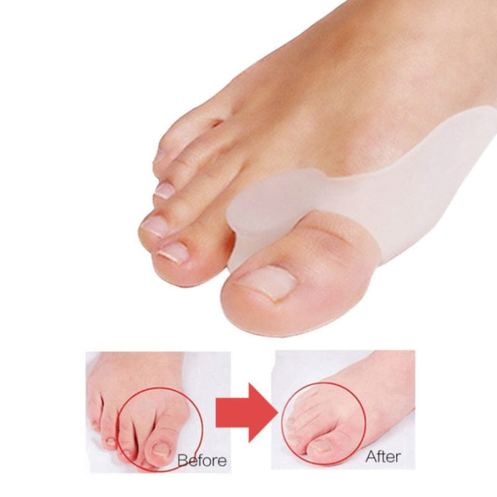 Vartalokauppa Hallux Valgus Oletusotsikko Varvasseparatorit (hallux valgus, 2-pakkaus)