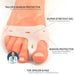Vartalokauppa Hallux Valgus Oletustunnus Välikappale Hallux valgus